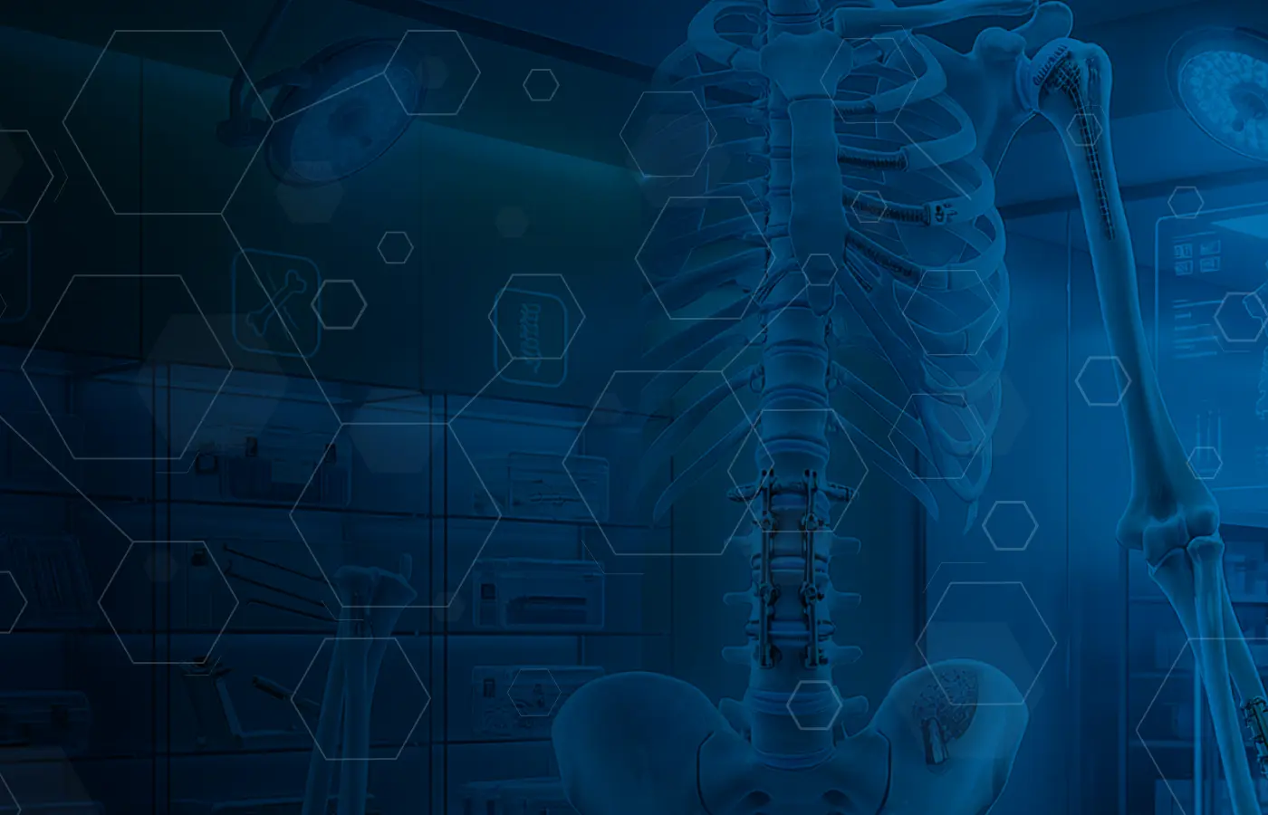 Implantes quirúrgicos