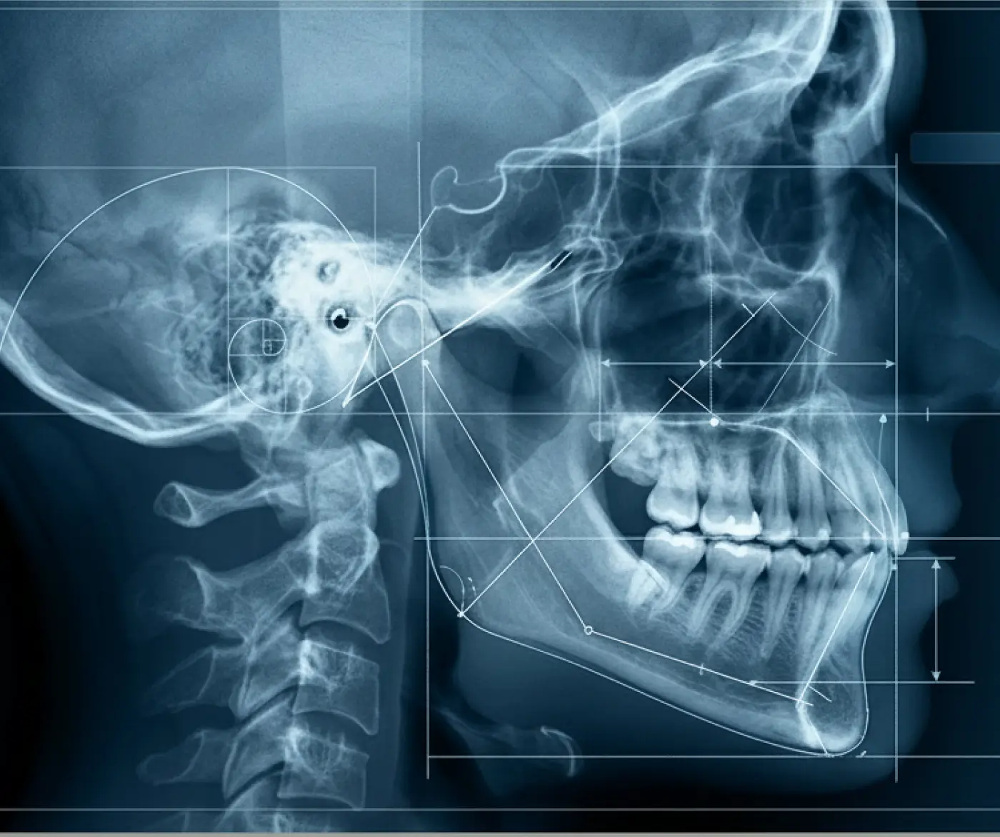 Craneales y Maxilofacial